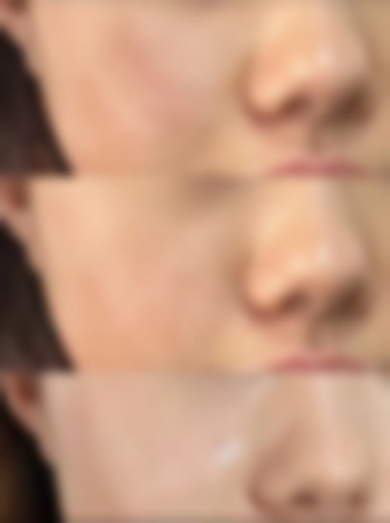 性价比高的合资隆胸假体有哪些