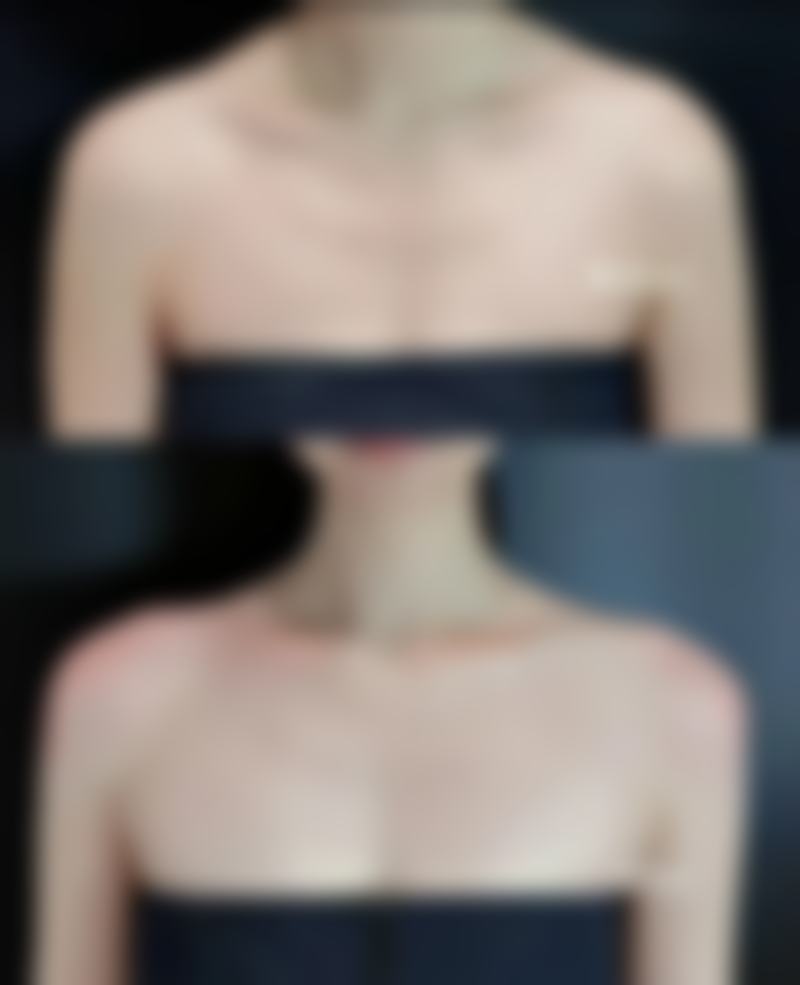 方涛医生简介项目优势