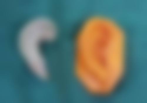 刘定英医生简介医生顾客实例图片