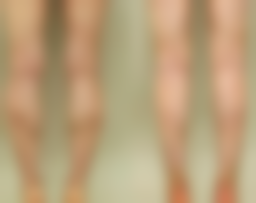 耳软骨隆鼻不住院的可行性及术后护理要点