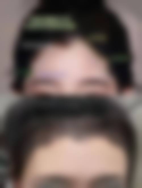 临沂市皮肤病医院医学美容中 心口碑好不好