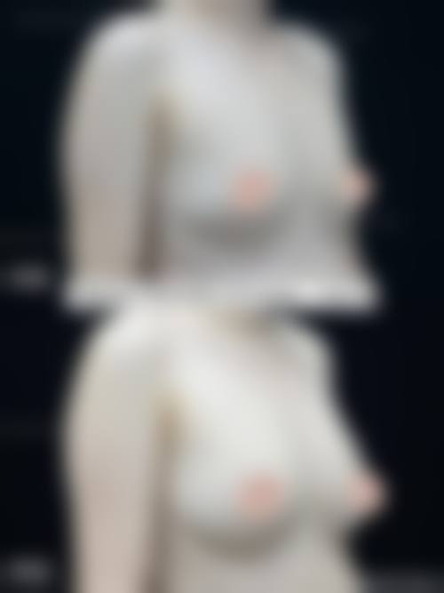 深圳蔚岚医疗美容诊所怎么样，可靠吗