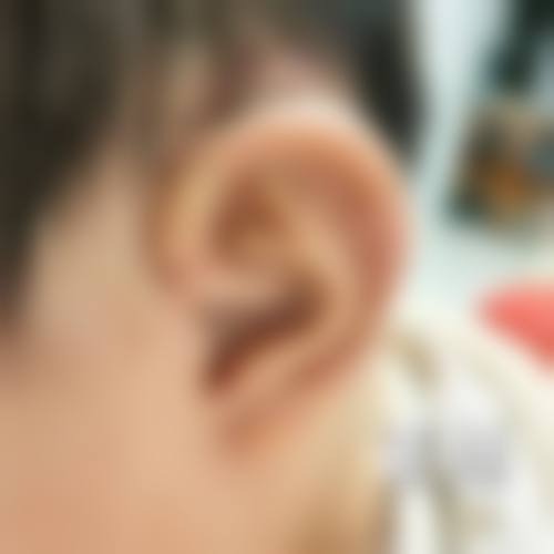 熊伟汉医生做手术价格