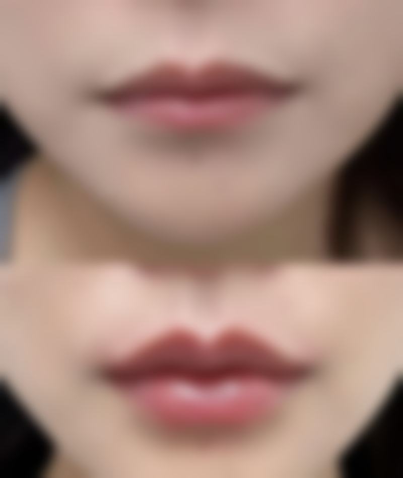 克拉玛依尚美莱医疗美容诊所更擅长什么手术