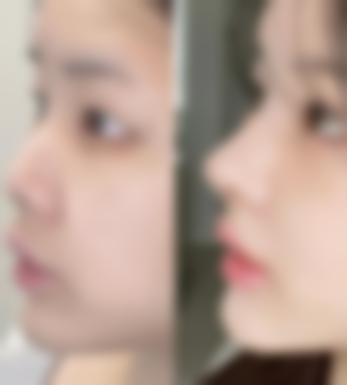 泰安美娜多医疗美容诊所怎么样，价格表