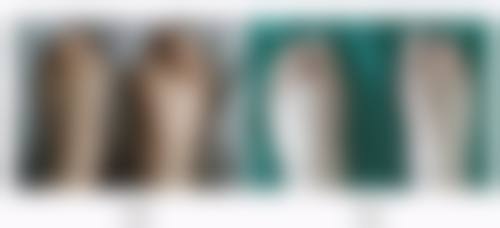 每天眼部按摩能去眼袋吗之按摩原理:为何揉揉就能有效