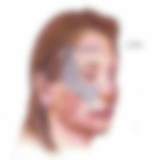 每天眼部按摩能去眼袋吗之副作用:安心指南必看