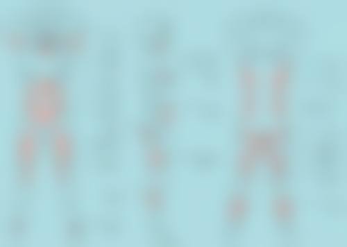 眼袋黑眼圈可以自愈吗——DIY护理红黑榜