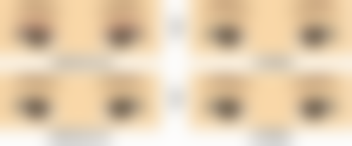 做抽脂手术术后快速修复的5大黄金法则