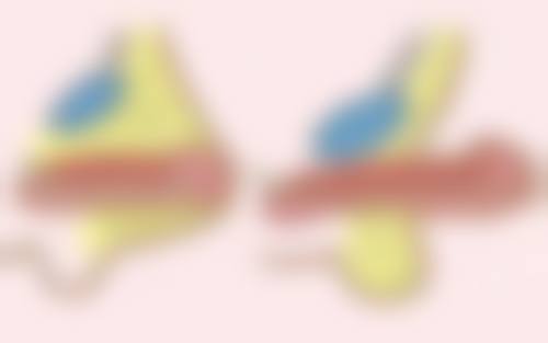 专精医生建议较大化热玛吉眼部除皱成效论证