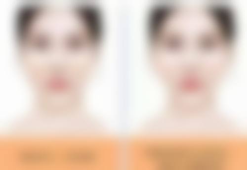 李永涛医生简介项目优势