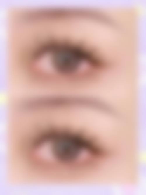 乔福萌医生项目优势亮点