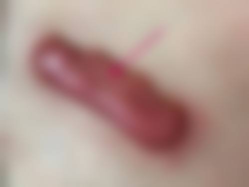 乔福萌医生手术价格情况