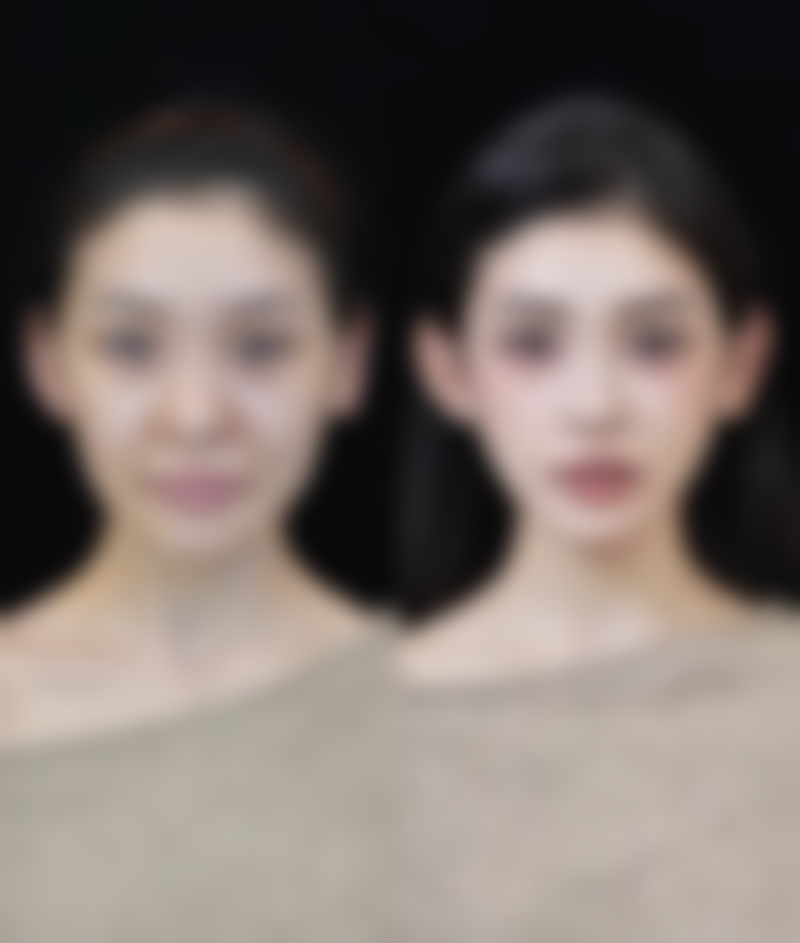 每天眼部按摩能去眼袋吗之能否消除眼袋:期望值要合理