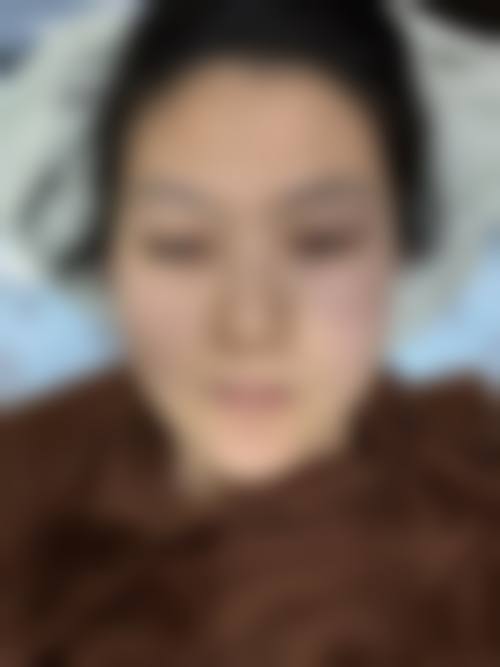 重庆宏仁医疗美容门诊部价格表