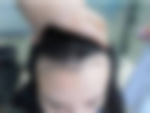 俞惠忠医生简介口碑如何