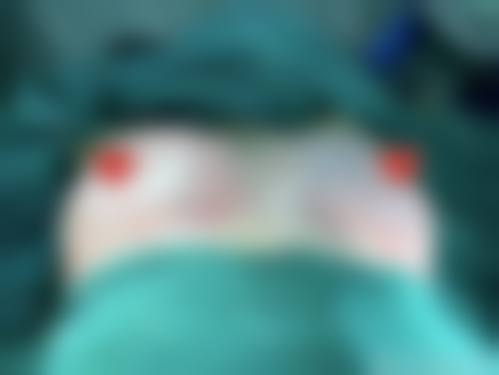 陈咸伸医生简介怎么挂号