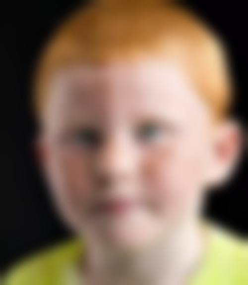 昆明悦格医疗美容诊所怎么样，价格表