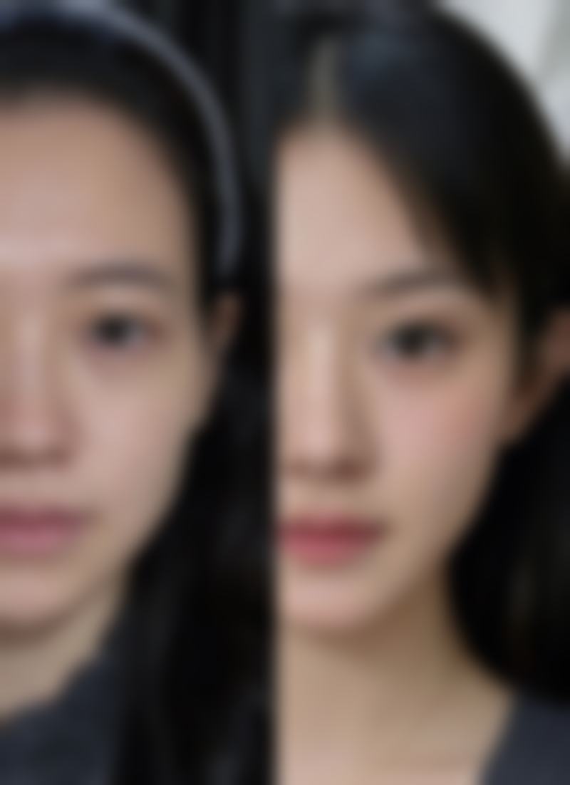 疤痕疙瘩怎么去除呢：治疗费用参考