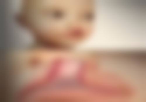 曹思佳医生简介做手术价格