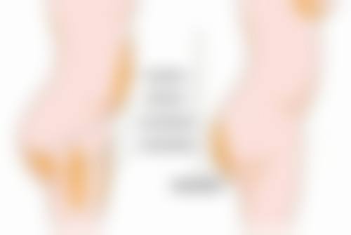 做完双眼皮一个月哭了会影响效果吗？医生解析肿胀、留疤、感染三大关键问题