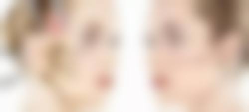 上海的中医和西医结合妙招，助力凸出疤痕变平