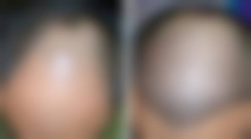 济南槐荫艺佳人整形美容诊所评价