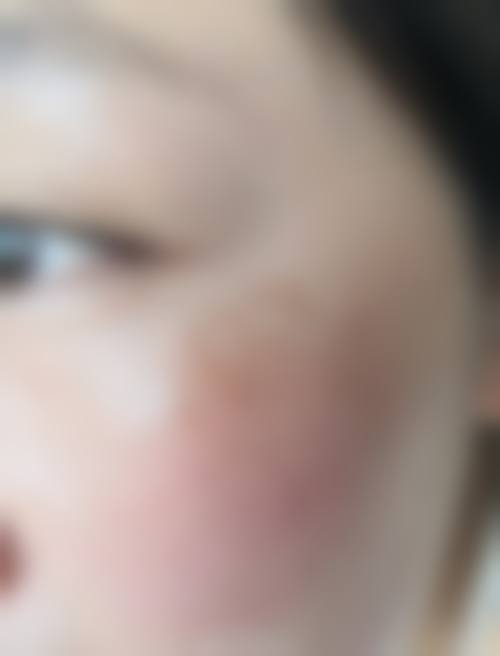 郑州杨小顺医疗美容诊所怎么样，评价