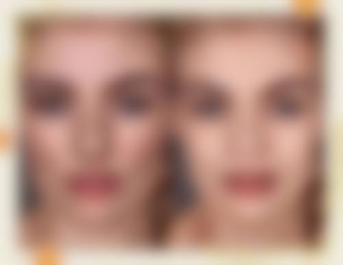 李艳东医生顾客实例图片