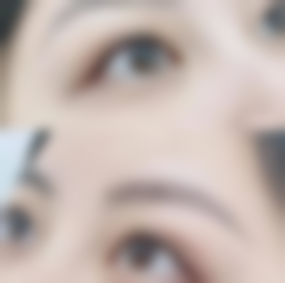 做双眼皮抹什么能消肿：综合消肿方案——1 + 1 > 2的“梦幻组合”