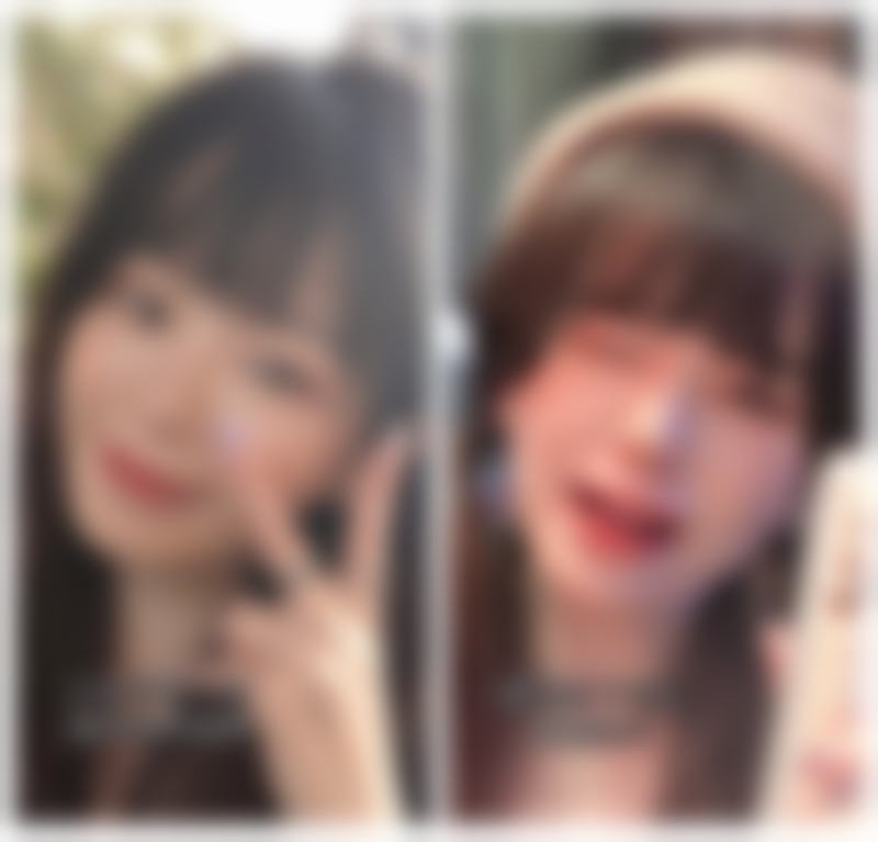 做双眼皮抹什么能消肿：芦荟胶——自然派的“争议选手”