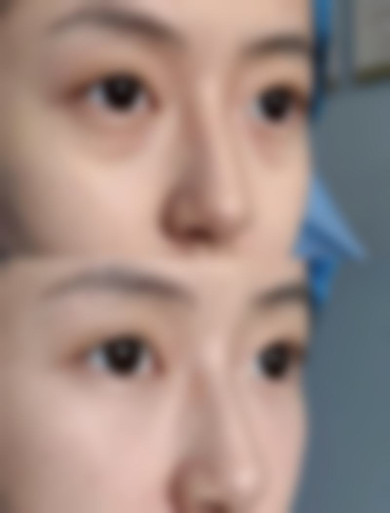 廊坊万福医院整形美容科口碑好不好