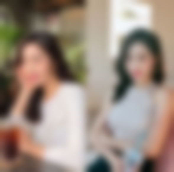 怎么样可以变成双眼皮呢——手术方案：一劳永逸的美丽投资