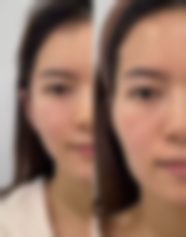 韩国clubmiz lamiche医院项目特色