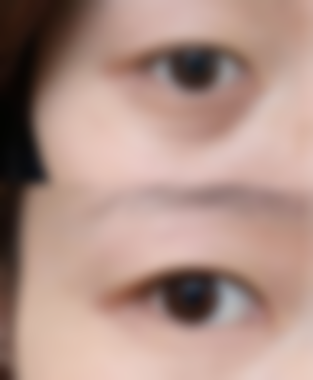 青岛熙朵医疗美容整形医院项目特色怎么样