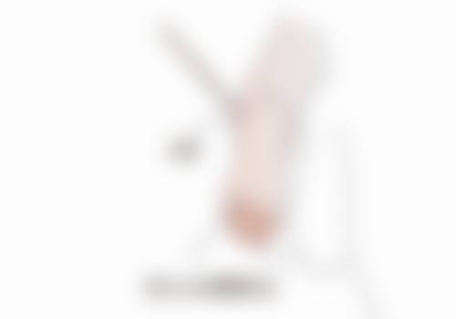 疤痕膏对手术疤痕的局限性:何时需寻求其他治疗方式