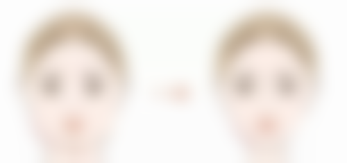 疤痕膏对不同手术疤痕的适用性:常见类型及适用场景