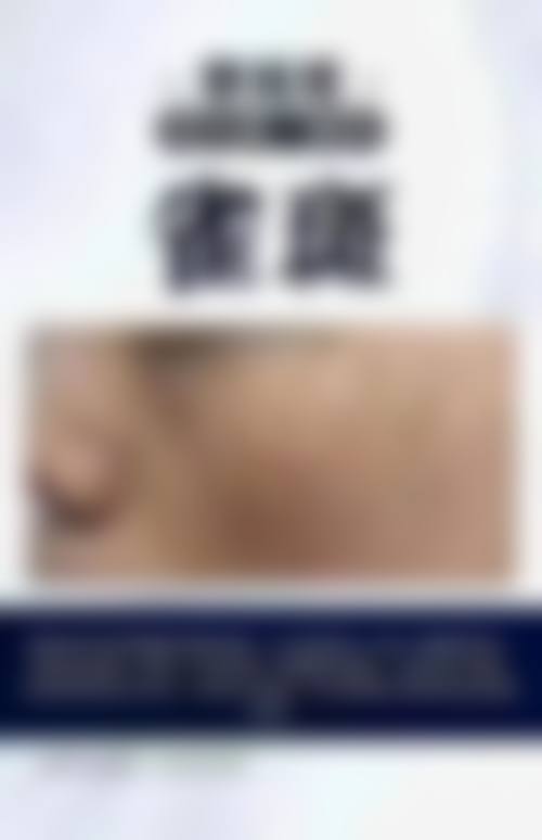 杭州悦可医疗美容诊所陈彩媛特色技术与专项成果