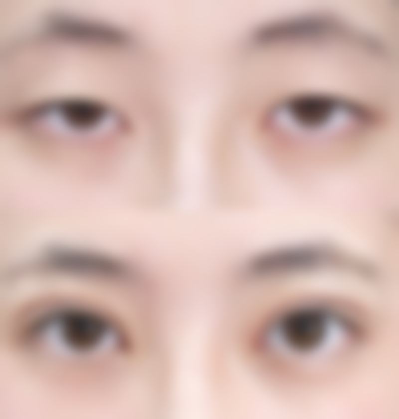 华 山医生患者实例