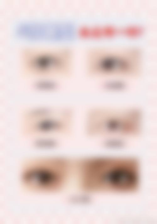 郭向阳医生怎么挂号