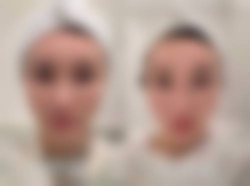 胡以信医生简介做手术价格