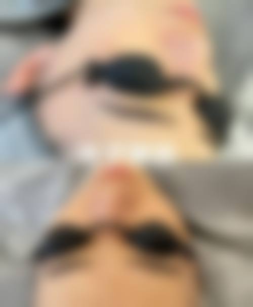 合肥格莱美整形医院怎么样价格表