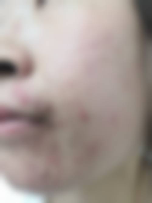 广州维纳斯医疗美容门诊部怎么样？地址在哪里