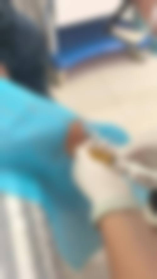 黄拔瑞医生简介做手术价格