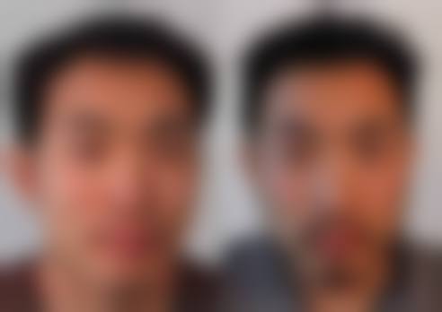 郭晓辉医生怎么挂号