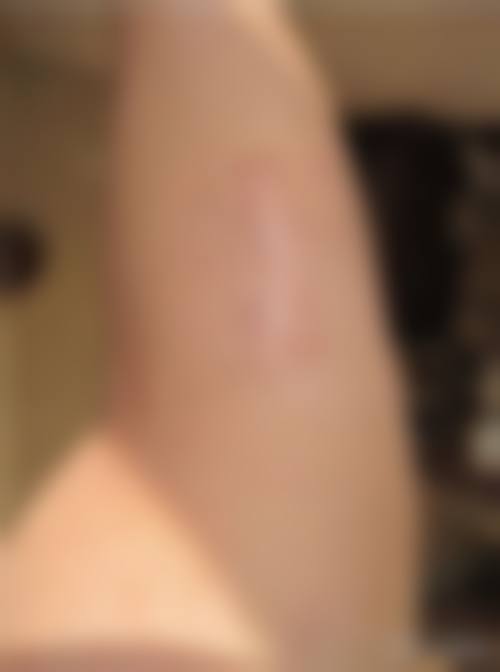 桂林叶氏嘉美（叶向东）医疗美容门诊部顾客实例