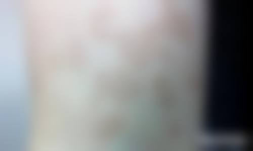 广州维纳斯医疗美容门诊部怎么样？特色项目如何