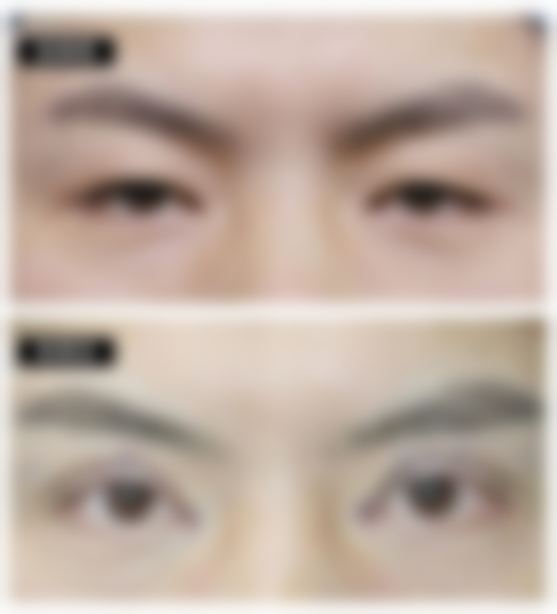 福建泉州海峡医疗美容门诊部价格表是怎样的？