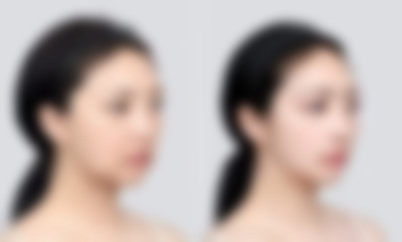 郭向阳医生项目优势