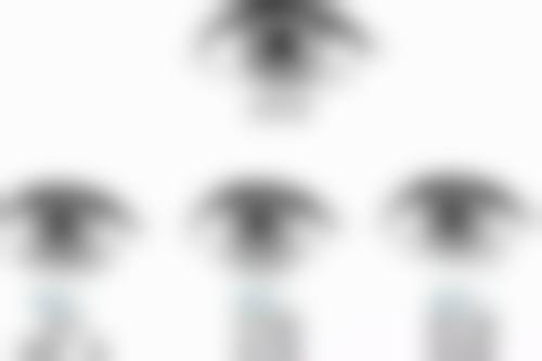 50岁做双眼皮全切的价格考量